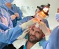 Sorin Brotnei a făcut cel de-al doilea transplant de păr foto: Instagram 