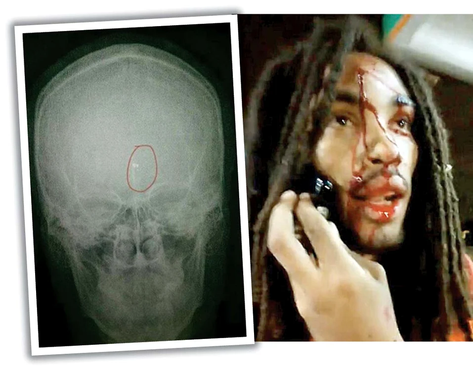 
    Teriq Royal, de 23 de ani,  a fost împuşcat cu o puşcă AK-47  