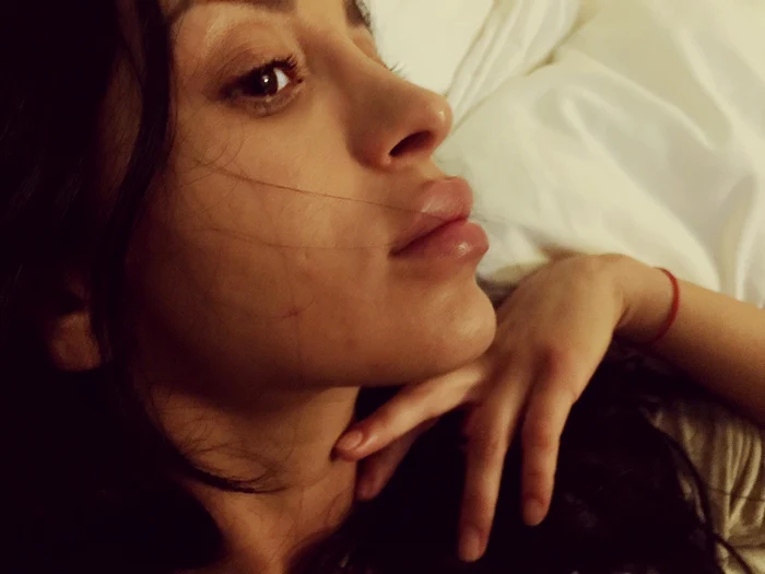 Ruby a cam exagerat cu substanţa injectată în buzefoto: arhivă personală