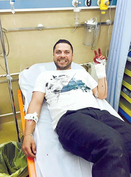 30 mai Viziru  și-a retezat  degetul mare  în finala de  la “Fermă”