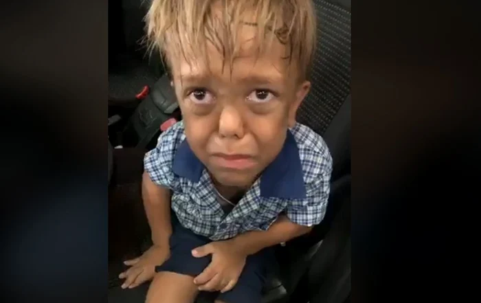 
    Un copil de 9 ani cu probleme medicale îi spune mamei lui că vrea să moară din cauza colegilor care râd constant de elFoto: Captură Video  