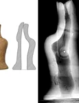 Secretul de fabricație al unei statuete aparținând Culturii Cucuteni, dezvăluit de o radiografie jpeg