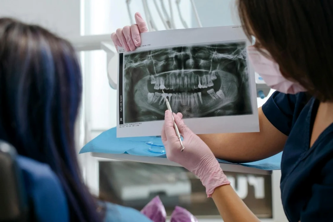 Implant dentar intrebari pe care merita sa le adresezi medicului inainte de interventie jpg