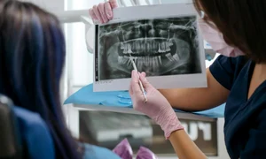 Implant dentar intrebari pe care merita sa le adresezi medicului inainte de interventie jpg