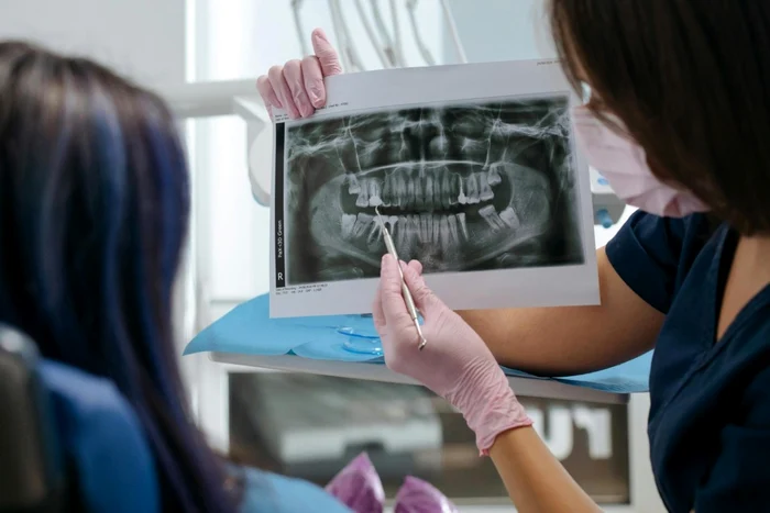 Implant dentar intrebari pe care merita sa le adresezi medicului inainte de interventie jpg