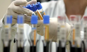 1 coronavirus jpg jpeg