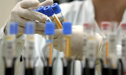 1 coronavirus jpg jpeg