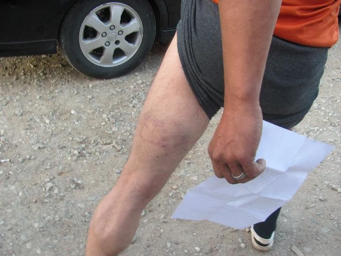 Mai multe persoane ii acuza pe jandarmii sibieni de violente