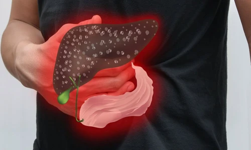 1 71795 original jpg jpeg