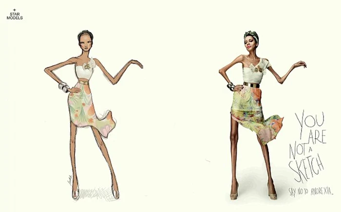 anorexica 3