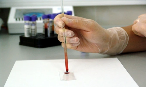 1 80403 original jpg jpeg