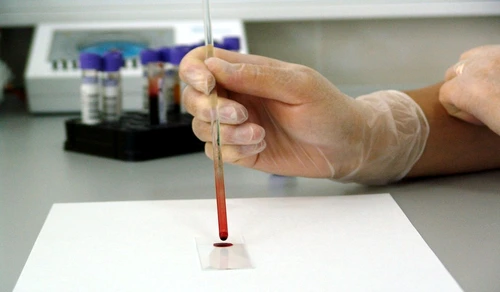 1 80403 original jpg jpeg