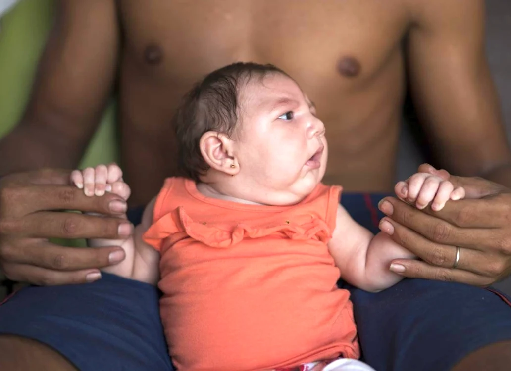 Virusul Zika provoacă malformaţii la copii nenăscuţiFoto: Gizmodo