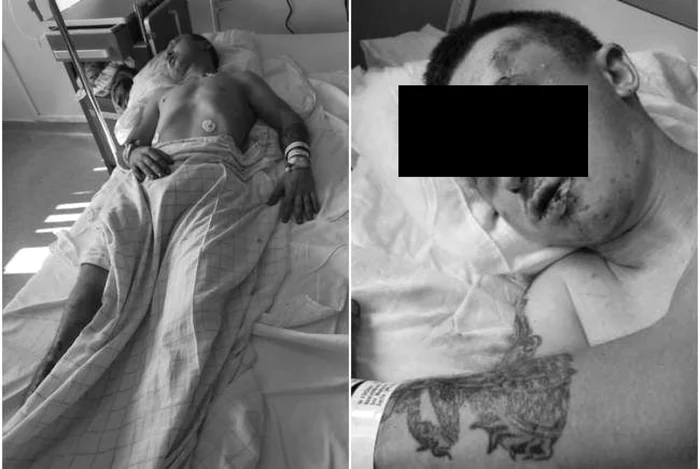 Bărbatul este internat FOTO Aradon.ro