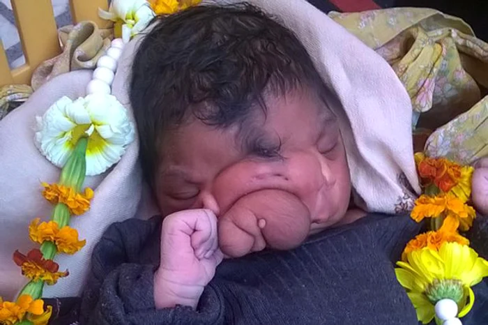 
    Copila împlineşte o săptămână  