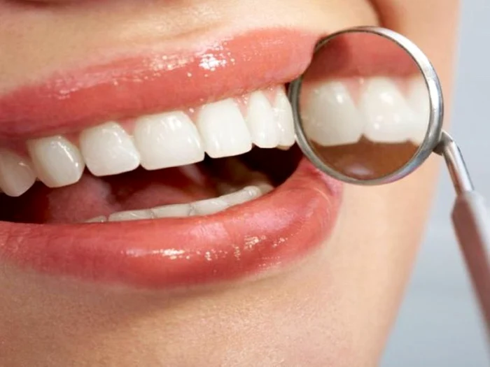Leacuri contra gingiilor inflamate