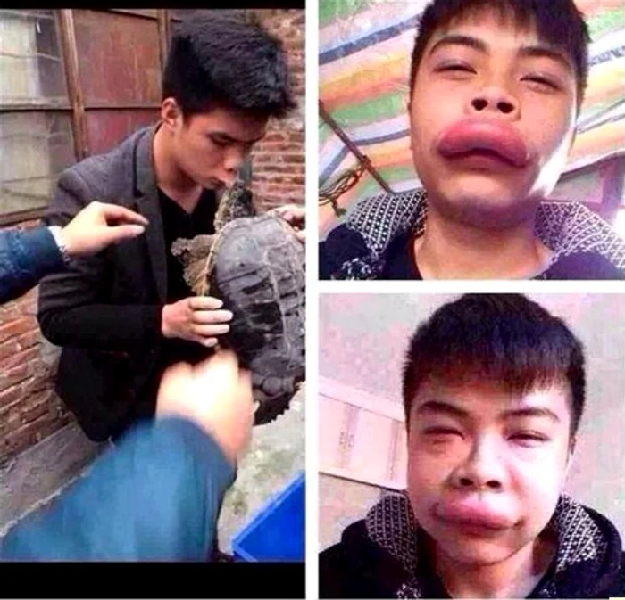 Buza muşcată de broasca ţestoasă şi-a mărit de câteva ori volumul iniţial