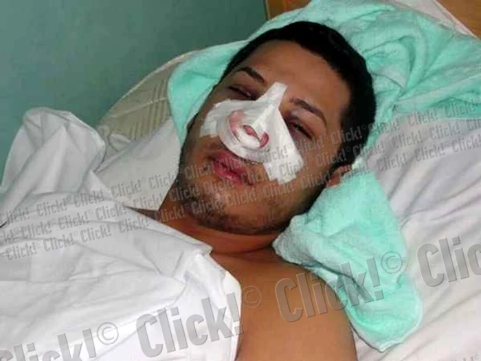 Adrian Pescariu încearcă să se recupereze după accident.