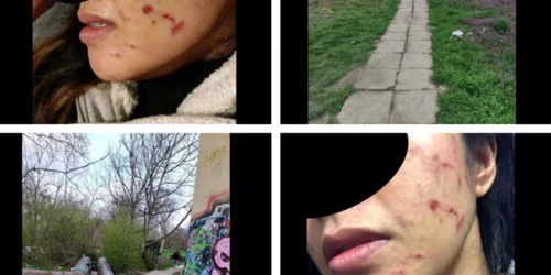 femeie agresata timisoara FOTO tion.ro