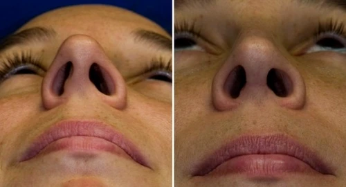 1 83003 original jpg jpeg