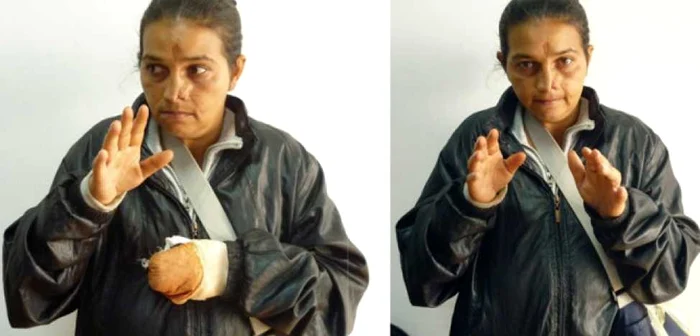 Cerşetoarea nu avea nicio problemă la mână FOTO Poliţia Locală