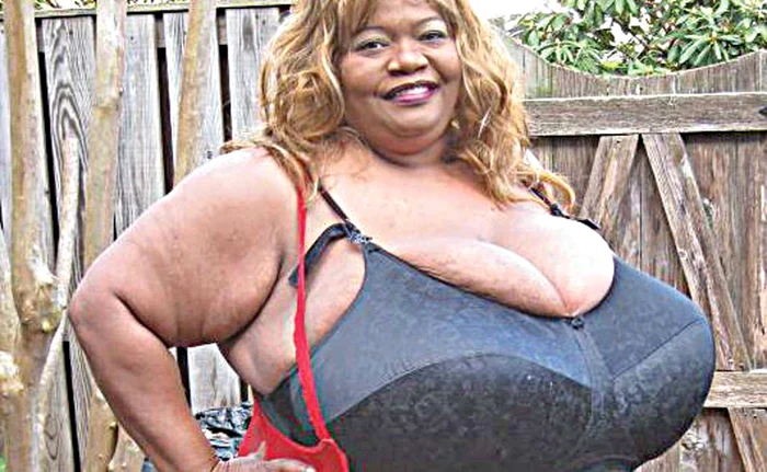 
    Sânii ei cântăresc  29,4 kilograme  fiecare  