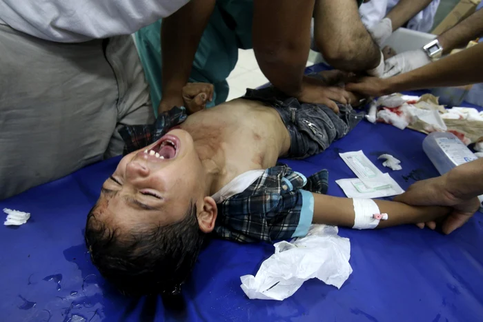 Medici palestinieni tratează un băiat care a fost rănit într-un bombardament israelian la un spital în Rafah sudul Fâşiei Gaza FOTO Reuters