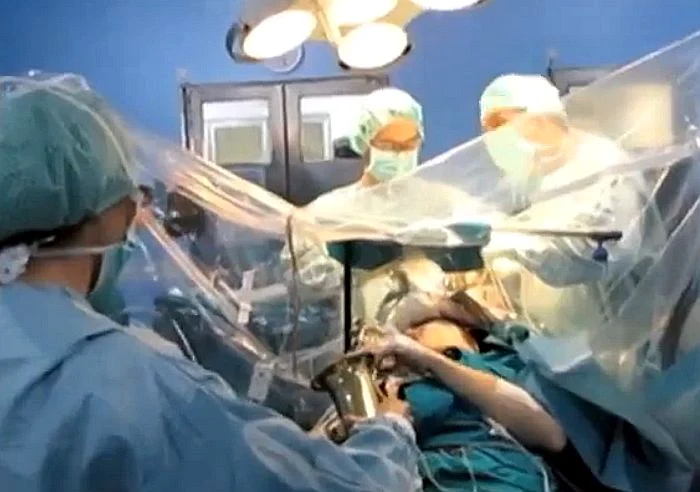 
    Operația pe creier a fost realizată cu succes de către chirurgii spaniolifoto: captură video  