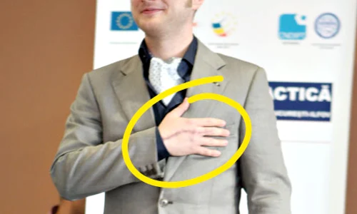 Pe mâna dreaptă încă  se mai vede cicatricea jpeg