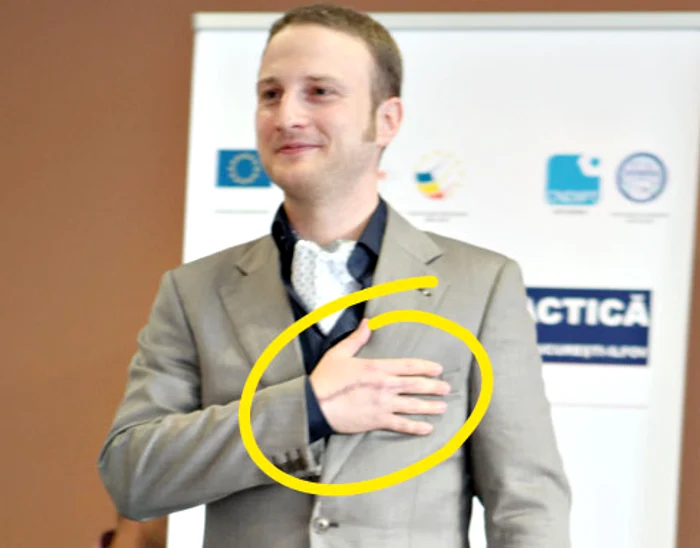 Pe mâna dreaptă încă se mai vede cicatricea