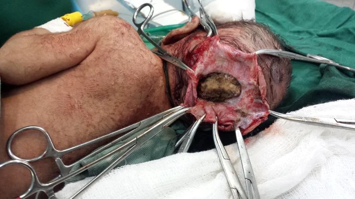 Fetiţa cu două capete (foto:afp)