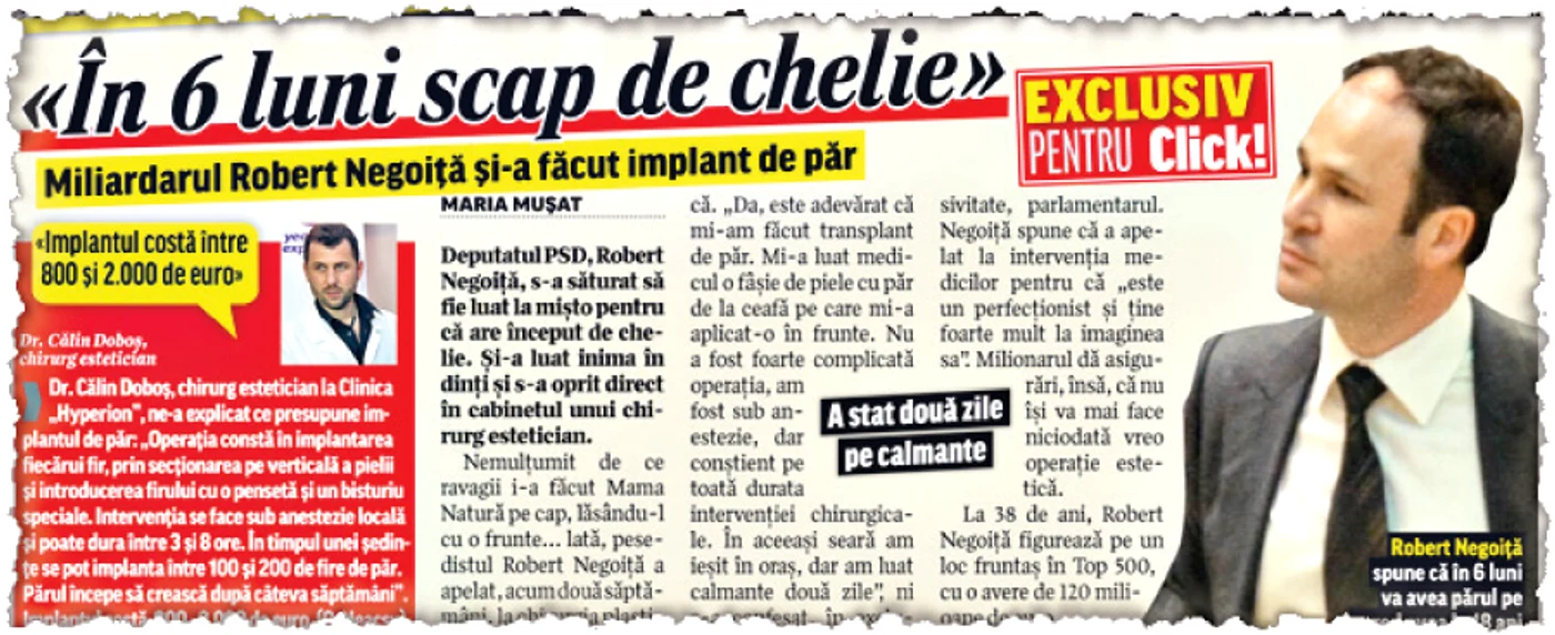 Robert Negoiţă şi-a făcut implant de păr. Asta îl paşte şi pe Mihai