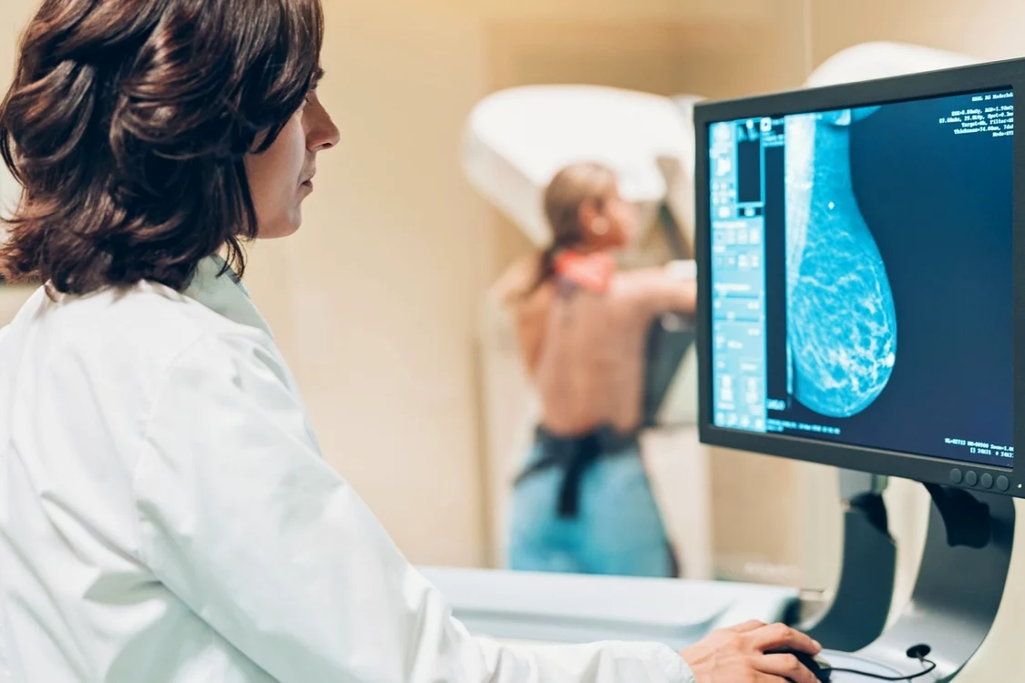 Femeile nu beneficiază de decontarea mamografiilor / Foto: Arhivă