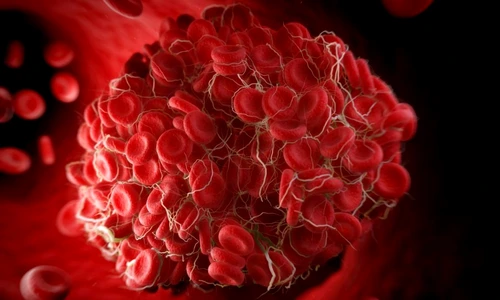 1 81332 original jpg jpeg