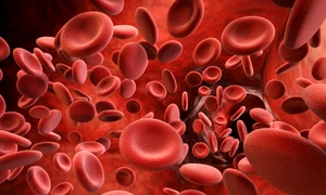 hemofilie foto Medline Plus jpg