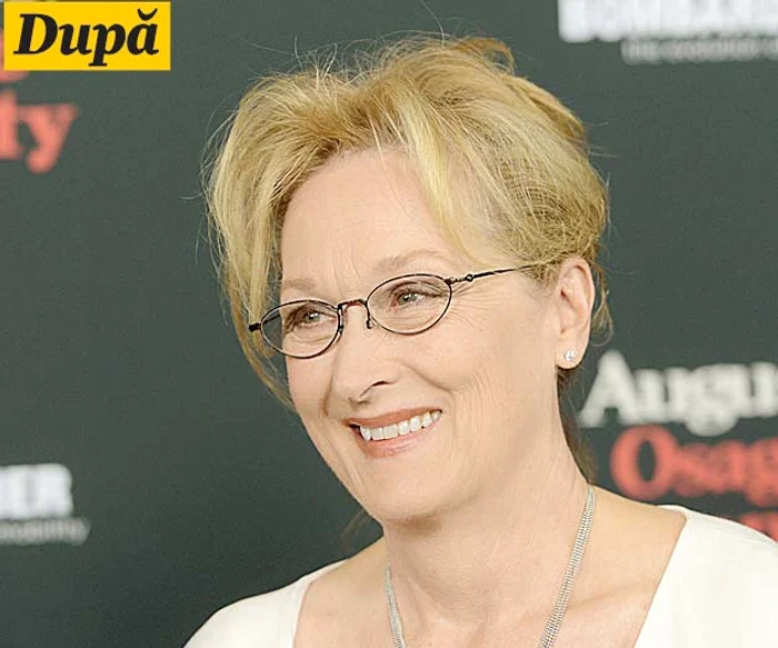 La nici 20 de ani, Lindsay Lohan  (27 de ani) şi-a făcut nenumărate  injecţii cu botox, în perioada  în care avea probleme cu legea