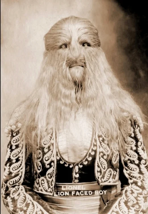 „Copilul cu chip de leu” / FOTO: Atlas Geografic