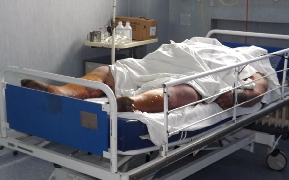 
    Bărbatul pe patul de spital. (Foto: Corina Macavei)  