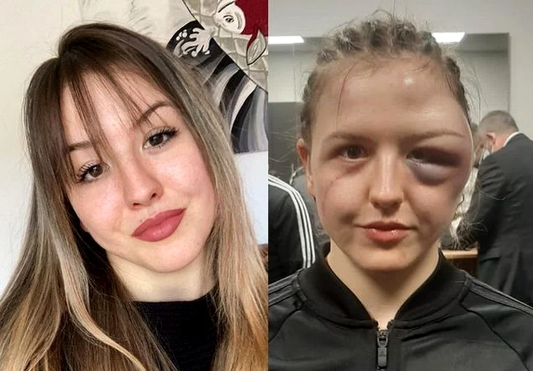 
    Cheyenne ”Pepper” Hanson, înainte și după meciFOTO: Instagram  