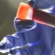 Medical lab technician holding sample blood webp