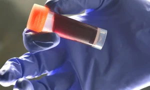 Medical lab technician holding sample blood webp