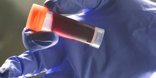 Medical lab technician holding sample blood webp