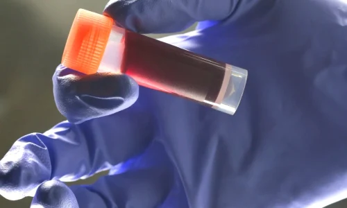 Medical lab technician holding sample blood webp