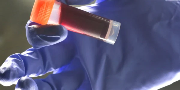 Medical lab technician holding sample blood  webp