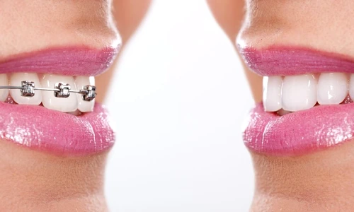 1 73526 original jpg jpeg