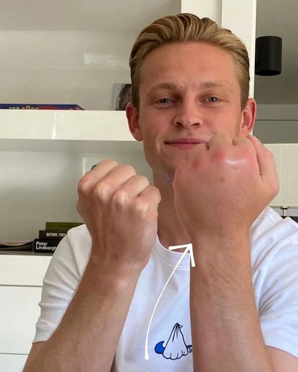 De Jong s-a ales cu mâna dublă după ce a fost înțepat de albină