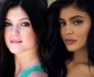 7 kylie jenner operatii estetice 2 jpg jpeg