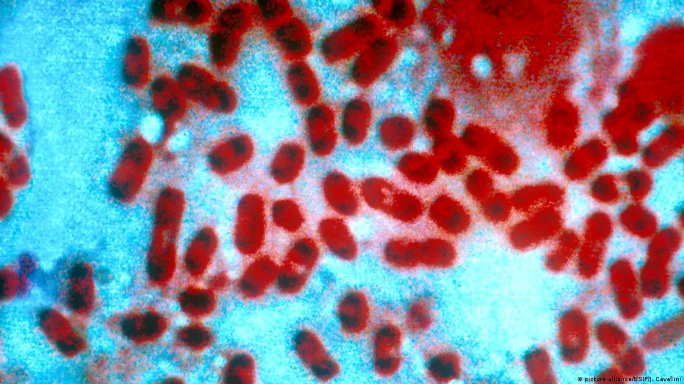 Yersinia pestis la microscop