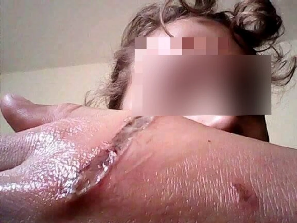 
    Puştoaica de 13 ani a suferit răni îngrozitoareFoto: "Adevărul"  