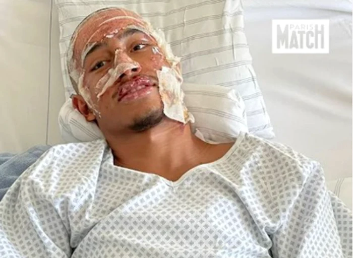 Tahirys Dos Santos, fundaș stânga în vârstă de 19 ani  Foto X / parismatch